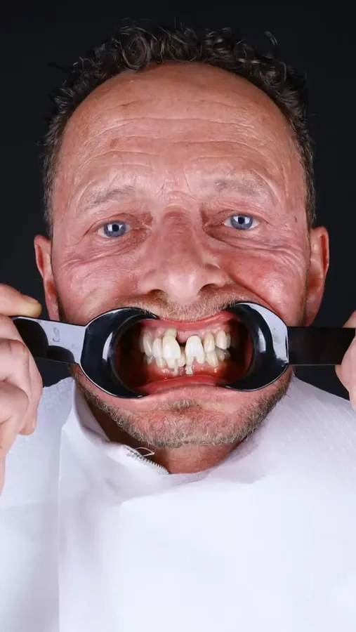 Diş eti ve diş muayenesi — periodontal değerlendirme